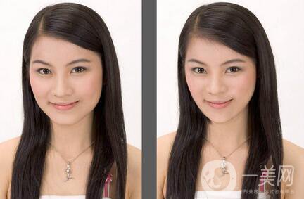 下頜角截骨手術(shù)會(huì)復(fù)發(fā)嗎？