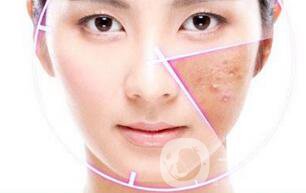 做果酸換膚多少錢一次 果酸換膚具體價格