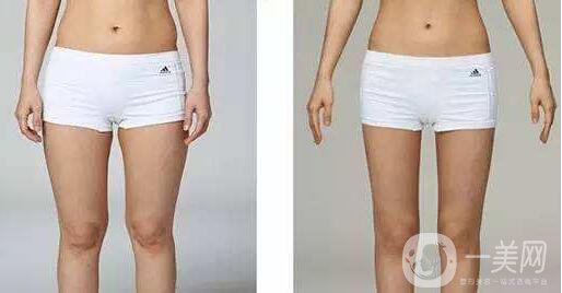 *瘦小腿,價(jià)格