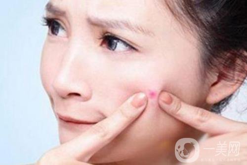 像素激光祛痘疤費(fèi)用一般要多少錢(qián)？