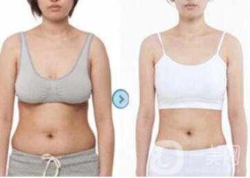 水動力溶脂減肥