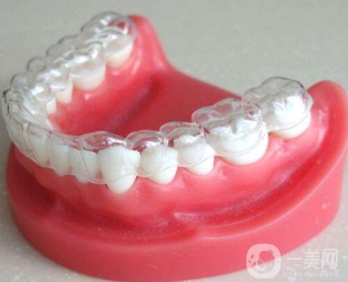 t4a牙齒矯正器*果好不好 有哪些作用