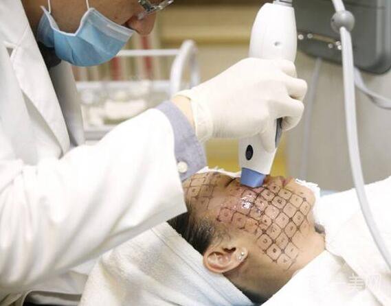 熱瑪吉*果好嗎 熱瑪吉可以緊膚除皺嗎