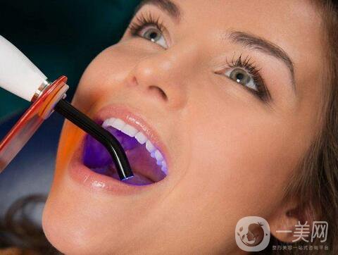 皓齒美白牙齒多少錢 皓齒美白潔牙費用