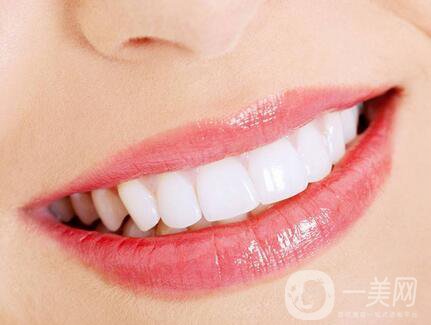 皓齒美白牙齒多少錢 皓齒美白潔牙費用