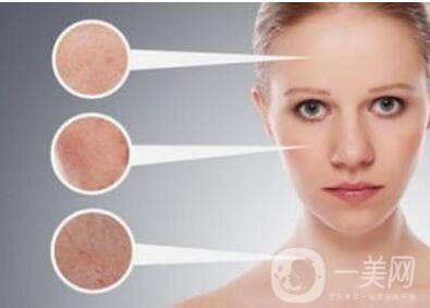 c6激光祛斑,多少錢