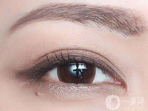 開眼角多少錢？ 開眼角價格是多少？