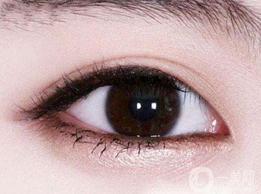 紋眼線好嗎 怎么選擇醫(yī)院