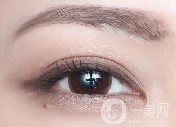 不開刀的雙眼皮方式有哪幾種？