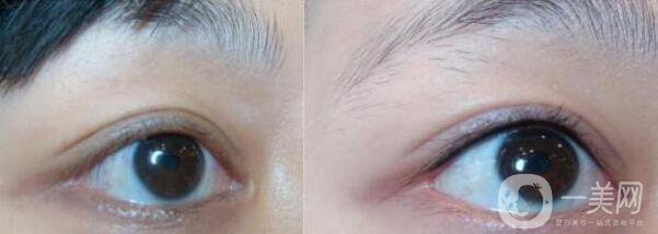 洗眼線較好的方法 怎么洗眼線*果好