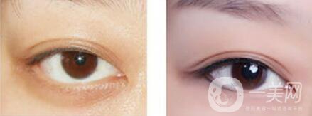 洗眼線多久能恢復(fù)  洗眼線幾天能好