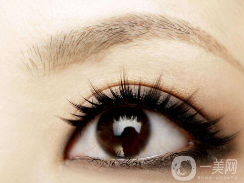 全切雙眼皮失敗怎么修復？