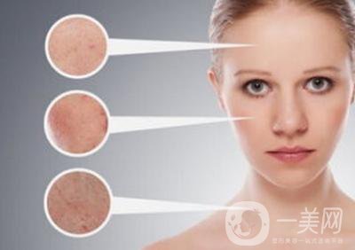 *風(fēng)范祛斑*果怎么樣？