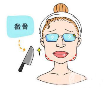 下頜角截骨手術(shù)頭套戴多久 恢復(fù)期要多久？