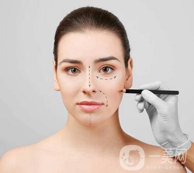 駝峰鼻矯正注意事項有哪些？