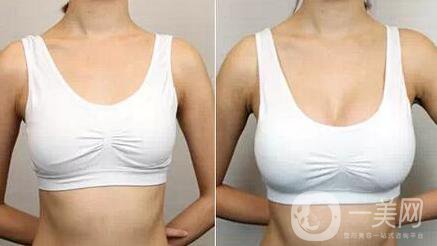 做豐胸手術(shù)時(shí)會(huì)痛嗎 術(shù)后恢復(fù)痛嗎