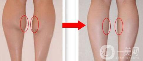 深圳**價(jià)格是多少