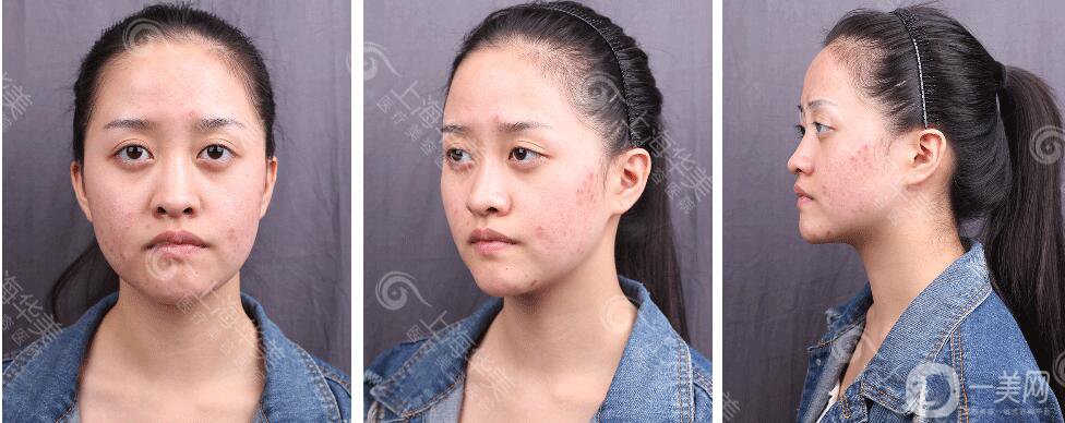 上海華美整形價格表2018發(fā)布 高級臉專屬定制項目曝光