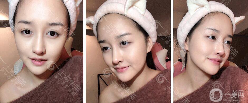 上海華美整形價格表2018發(fā)布 高級臉專屬定制項目曝光