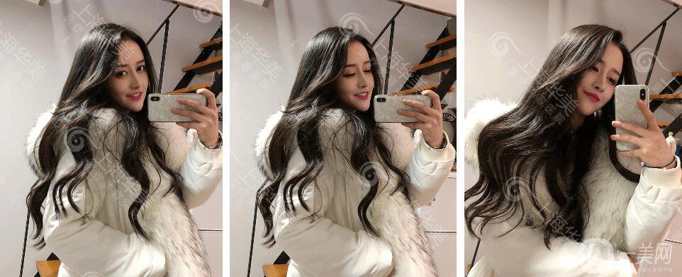 上海華美整形價格表2018發(fā)布 高級臉專屬定制項目曝光