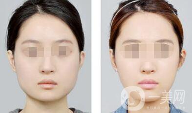 南京注射**價(jià)格是多少