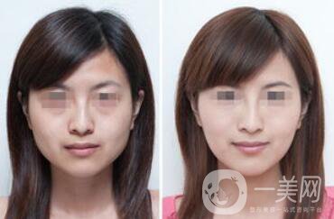 南京注射**價(jià)格是多少