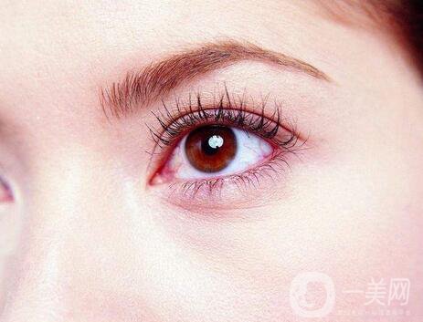 做開眼角的價(jià)格是多少錢？