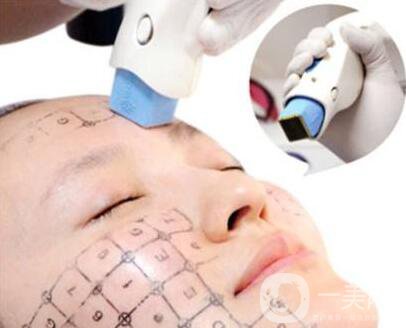 熱瑪吉除皺價(jià)格是多少錢？