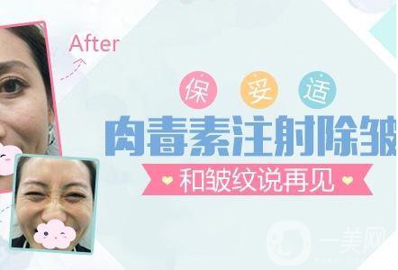 *,注射去皺,多少錢