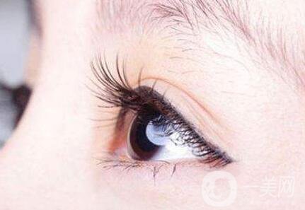 睫毛移植*果怎么樣？