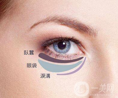 吸脂去下眼瞼眼袋怎么樣？