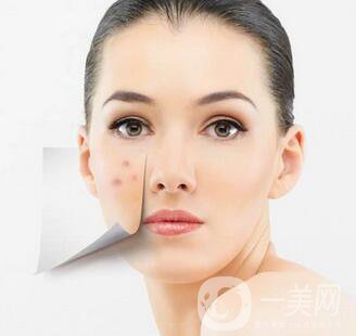 復(fù)合彩光祛痘印多久一次？