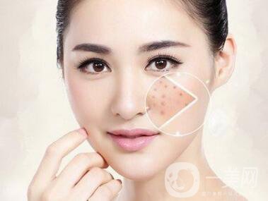 復(fù)合彩光祛痘印多久一次？