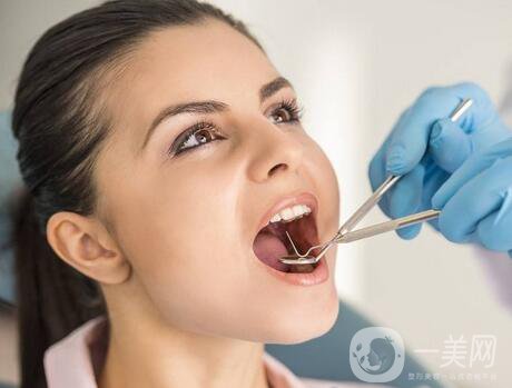 成都種植牙信息介紹？