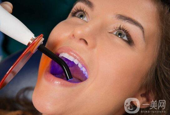 *潔牙注意事項(xiàng)有哪些？