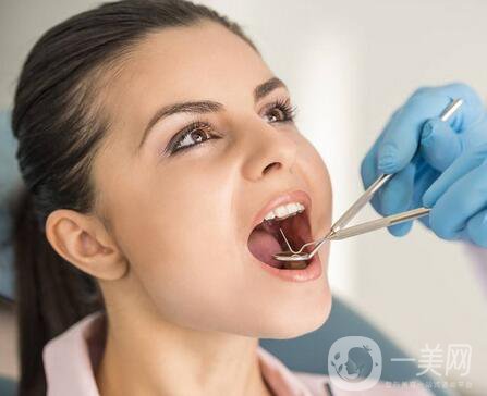 上海九院種植牙價格是多少？