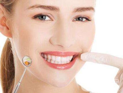 *潔牙價格多少錢一次？