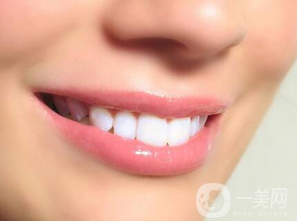 *潔牙價格多少錢一次？