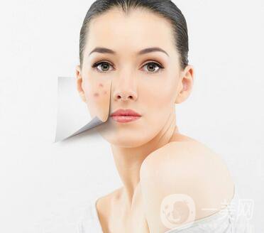 彩光祛痘原理是什么？