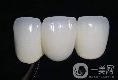 貴金屬烤瓷牙的危害有哪些？