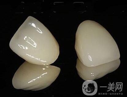 貴金屬烤瓷牙的危害有哪些？