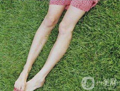 射頻溶脂,瘦小腿,*果,保持多久