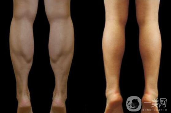*瘦小腿,*果好不好,圖片