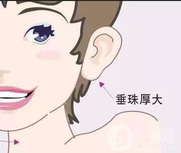 玻尿酸豐耳垂好嗎 相學解析有耳垂才有福氣
