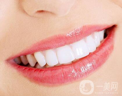 上海種植牙哪里*好？