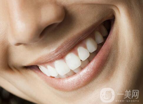 湖州種植牙多少錢一顆？