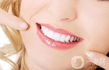 登騰種植牙價格便宜嗎？