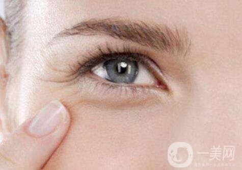 怎么除魚尾紋？有哪些方法？