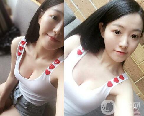 假體隆胸有什么危害？