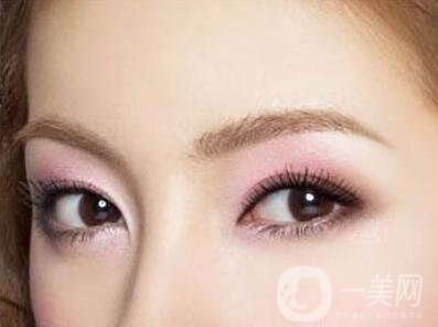 開外眼角術(shù)前注意事項介紹